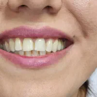 استخدام