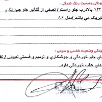 پژو رواRoA مدل 86|خودرو سواری و وانت|مینودشت, |دیوار