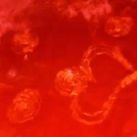 پتو|رختخواب، بالش، پتو|فردیس, منظریه|دیوار