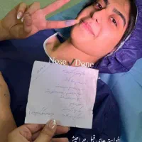عمل بینی رینوپلاستی فقط ۲۷ میلیون|خدمات آرایشگری و زیبایی|قم, جمکران|دیوار