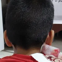 بادکش وحجامت|خدمات آرایشگری و زیبایی|قائن, |دیوار