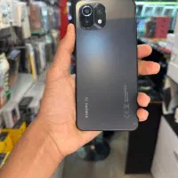 الان بخر ۱۲ماه دیگه پرداخت کن (8/128)mi11 lite 5g