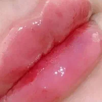 تزریق ژل،بوتاکس،پی آرپی،مزو تراپی،پلاسما جت|خدمات آرایشگری و زیبایی|بندر امام خمینی, |دیوار