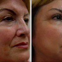 تزریق ژل،بوتاکس،سابسیژن،پی آرپی،مطب درمانی وزیبایی|خدمات آرایشگری و زیبایی|خرم‌آباد, |دیوار