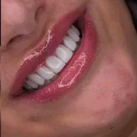 کامپوزیت ونیر|خدمات آرایشگری و زیبایی|شهریار, شهرک وائین|دیوار