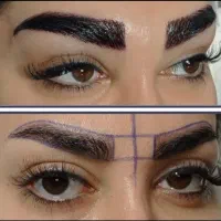 کاشت جراحی بینی غبغب سانترال دایرکت لمینت کامپوزیت