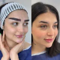 مرکز فوق تخصصی( کاشت مو ۱۴ م/کاشت ابرو ۱۰م)|خدمات آرایشگری و زیبایی|اندیشه, اندیشه فاز ۱|دیوار