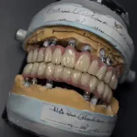 تکنسین دندانسازی ثابت