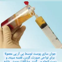 تزریقات سرم  و زیبایی ،فیلر بوتاکس prp|خدمات آرایشگری و زیبایی|اهواز, کمپلو شمالی|دیوار