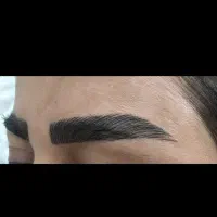 تخفیف ویژه میکرو(فیبروز)بدون دردرنگ تضمینی وترمیم