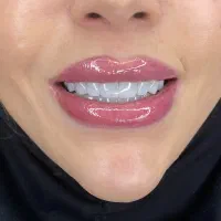 دندانپزشکی زیبایی جشنواره 50 درصدی با ضمانت|خدمات آرایشگری و زیبایی|تهران, نیاوران|دیوار