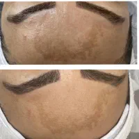 فیشال و پاکسازی پوست بانوان و آقایان