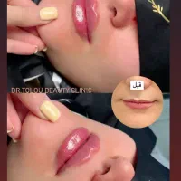 نیروی منشی و دستیار پزشک کلینیک زیبایی