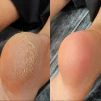 پدیکور درمانی|خدمات آرایشگری و زیبایی|اسدآباد, |دیوار