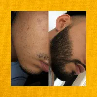 برای رویش فقط یه بار امتحان کن