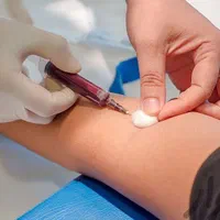 آموزش دوره تکنسین آزمایشگاه/نمونه گیر و پذیرش