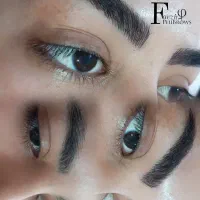 میکروبلیدینگ فیبروز شید خطچشم