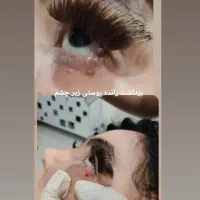 لیزر وزیبایی طلا|خدمات آرایشگری و زیبایی|سنندج, |دیوار