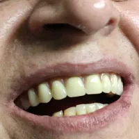 تخفیف ویژه کلیه خدمات دندانسازی برلیان|خدمات آرایشگری و زیبایی|تهران, سید خندان (جلفا)|دیوار