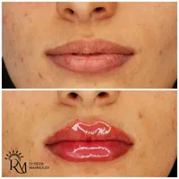 جشنواره  زیبایی کلینیک دکتر محمودی