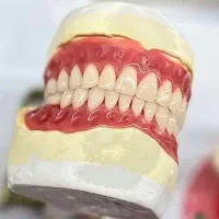 دندان مصنوعی با پرداخت اقساطی