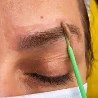 ریموو تخصصی تتوهای قدیمی با مواد فقط ۵۰۰