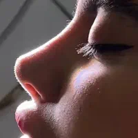 بینی مامو لیفت صورت