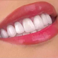 لابراتوار دندان سازی دنت رستور