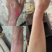 کلینیک تخصصی درمان زخم ( بستر و دیابت) فردوس|خدمات آرایشگری و زیبایی|اصفهان, بهار آزادی|دیوار