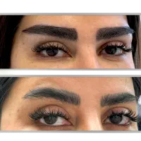 کاشت مو وابرو با سلول بنیادی فقط درکلینیک مرداویج