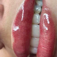 تخفیف ۲۰درصدی میکروبلیدینگ و شیدینگ لب