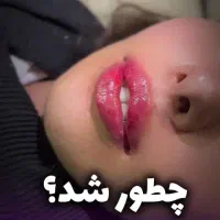 فیلر لب بوتاکس بلفاروپلاستی تخلیه غبغب مزوتراپی|خدمات آرایشگری و زیبایی|اندیشه, اندیشه فاز ۳|دیوار