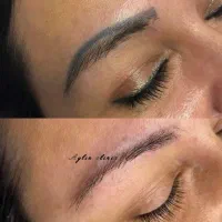 لیزر مو/تتو کربن فیلر ژل بوتاکس پی آر پی مزو درمطب|خدمات زیبایی و سلامت|اهواز, گلستان|دیوار