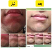 روغن های معجزه گر