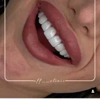 دستیار دندان پزشک