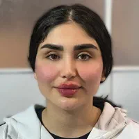 ژل لب و صورت سیسی ۹۰۰