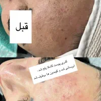 انجام تمامی خدمات پوستی