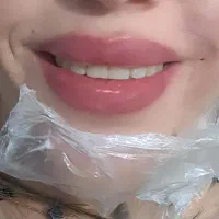 تزریق ژل+بوتاکس|خدمات آرایشگری و زیبایی|اهواز, پردیس دو|دیوار