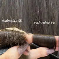 پکیج vipموخوره گیری و پروتئین تراپی سرد690
