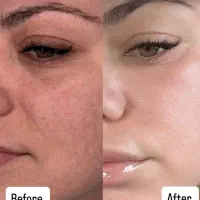 آقایان وخانومای رشتی پوست صاف و روشن حق شماست|خدمات آرایشگری و زیبایی|رشت, گلسار|دیوار