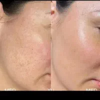 بزرگترین مرکز تخصصی لیزر درنسیم شهر