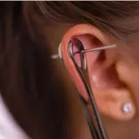 سوراخ کردن گوش  و برداشتن خال