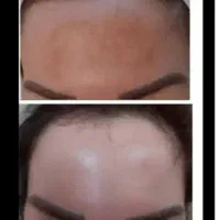 کرم طبیعی، معجزه