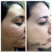 پوست کره ای|خدمات آرایشگری و زیبایی|ارومیه, |دیوار