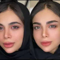 تغییر چهره با میکروبلیدینگ یک جلسة|خدمات آرایشگری و زیبایی|مشهد, بهار|دیوار