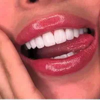 ارائه تمامی خدمات زیبایی با مناسب ترین قیمت|خدمات آرایشگری و زیبایی|تهران, دکتر هوشیار|دیوار