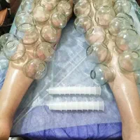 سم زدایی و پاکسازی بدن با حجامت تخصصی و ویژه