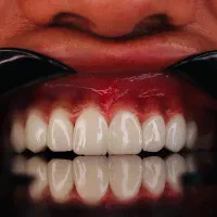 استخدام