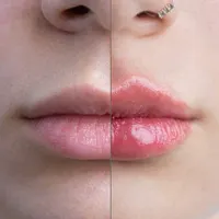 استخدام خانم فعال و با انگیزه در کلینیک زیبایی