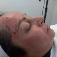 فیشیال تخصصی در محیطی آرام|خدمات آرایشگری و زیبایی|اصفهان, عسگریه|دیوار